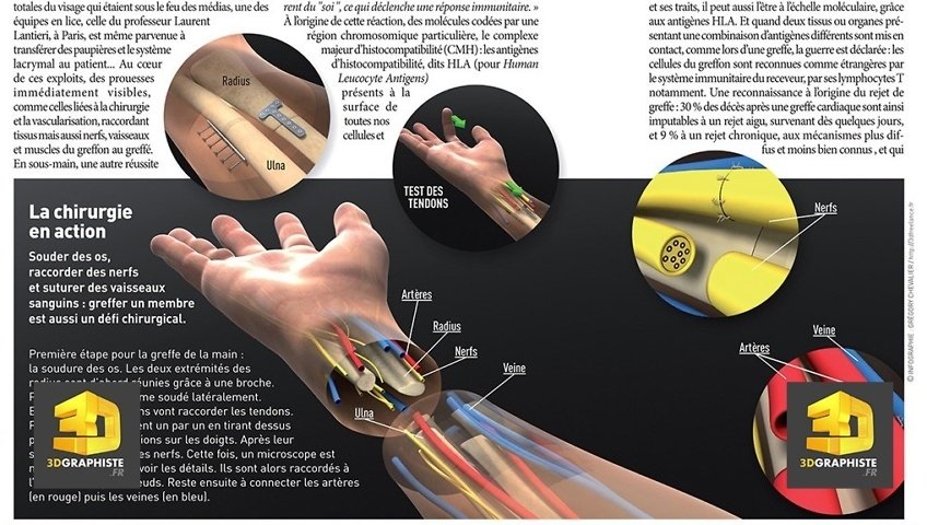 Illustration 3D pour magazine médical
