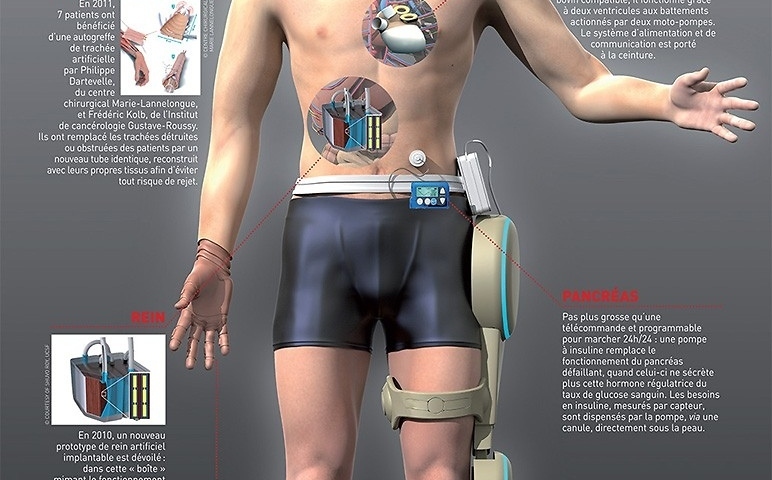 Reconstruction de corps humain - infographie-3d